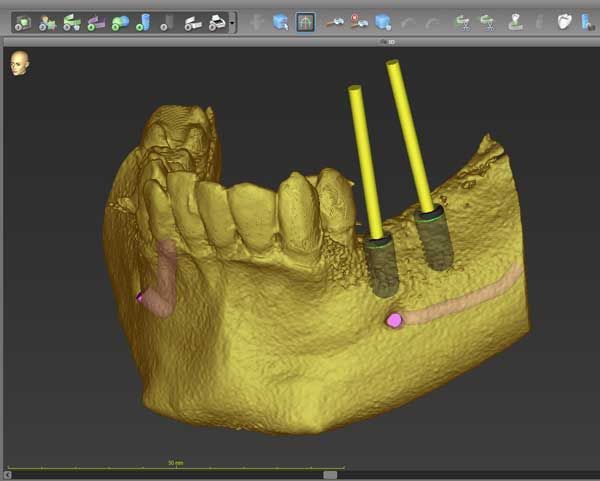 3D Zahnröntgen Screenshot