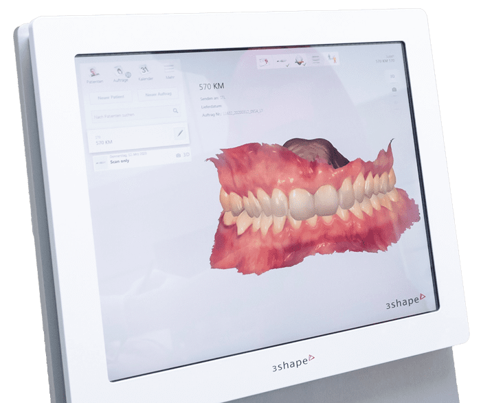 Bild von einem 3D Zahnröntgen auf Bildschirm